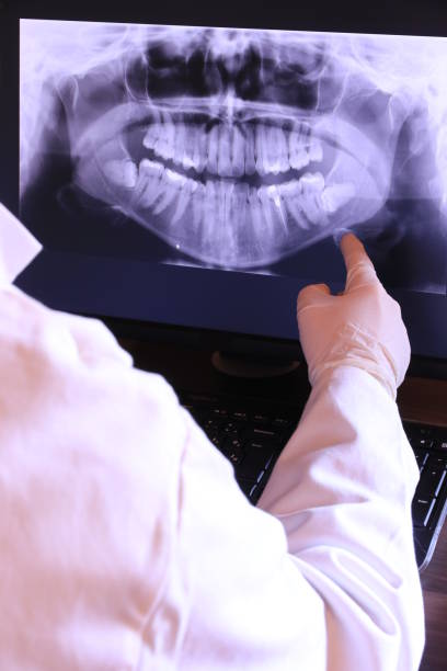 Best Broken or Chipped Tooth Repair in Riverdale Park, MD